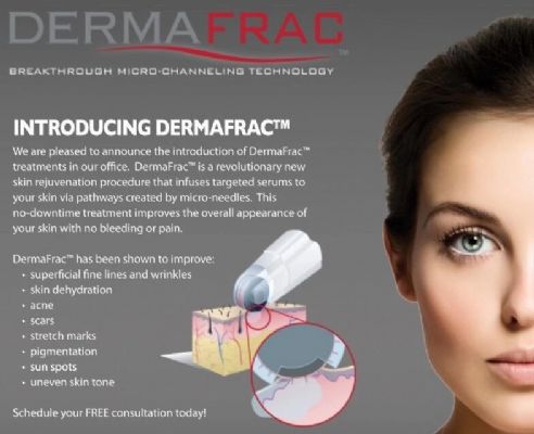 Bellafill填充维持5年或更久 图片 4