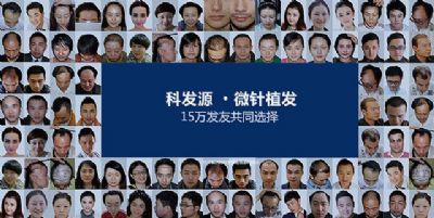 国内哪家种植头发的医院效果好 图片 2