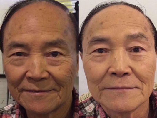 2分鐘洗出膠原蛋白質 photo 4