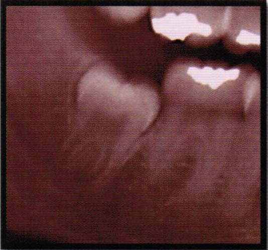 黃子律牙醫博士 图片 9