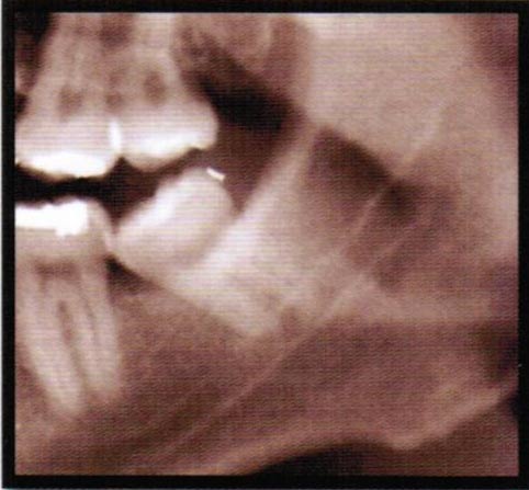 黃子律牙醫博士 图片 5