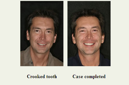 德林牙科診所─林俊男牙醫博士 图片 7