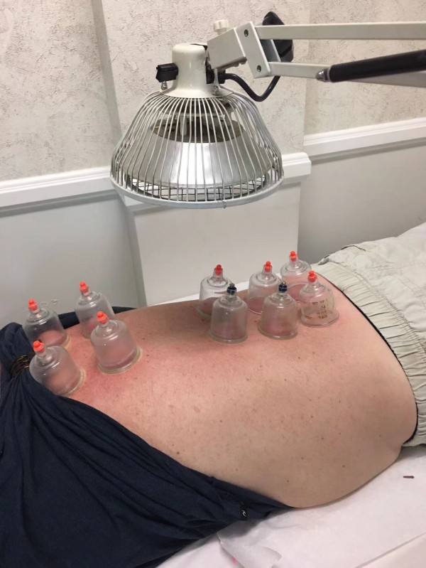 爾灣向陽中醫藥中心─針灸診療所 图片 5