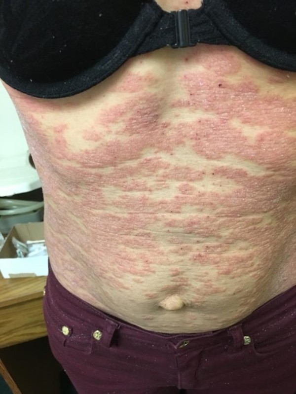 梁智鈞醫師(中)─鼻病專家‧免疫專科 photo 8