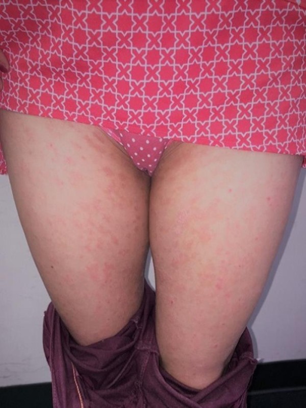 梁智鈞醫師(中)─鼻病專家‧免疫專科 photo 6