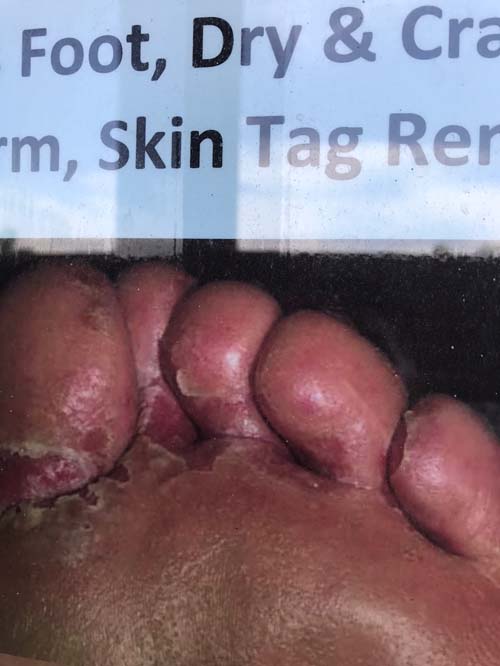 灰指甲手足癬專科診所 图片 1