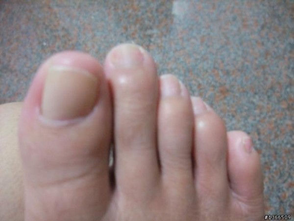 灰指甲手足癬專科診所 图片 5