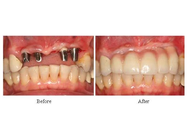歡欣牙科植牙中心─陳建和牙醫博士 图片 2