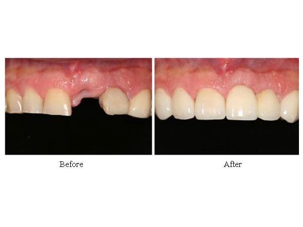 歡欣牙科植牙中心─陳建和牙醫博士 图片 3