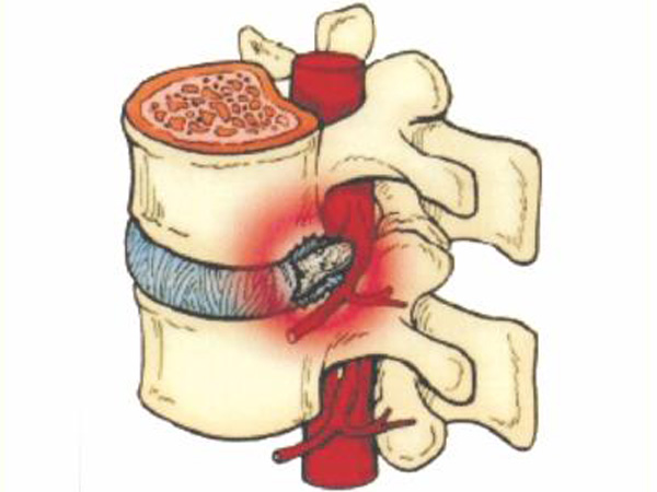 林心勉脊椎神經科醫師 图片 2