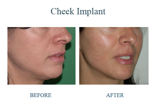 孫國鼎醫學博士─真善美整型美容中心 图片 7