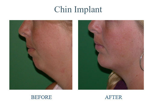 孫國鼎醫學博士─真善美整型美容中心 图片 8