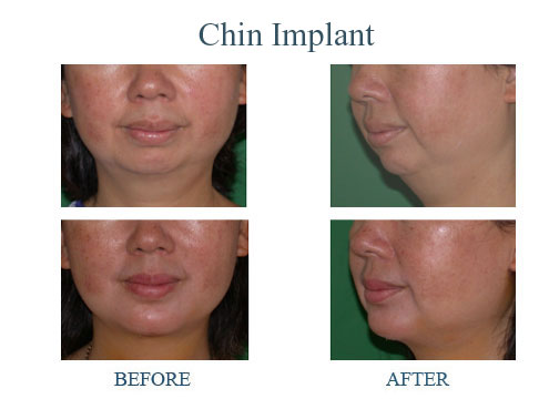 孫國鼎醫學博士─真善美整型美容中心 图片 9