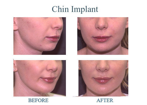 孫國鼎醫學博士─真善美整型美容中心 图片 6