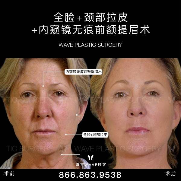 WAVE美亦恆整型外科集團─李建相醫師 图片 3