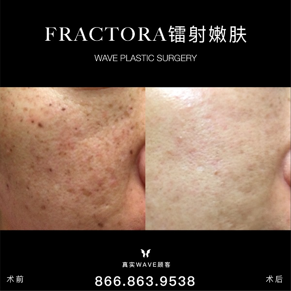 WAVE美亦恆整型外科集團─李建相醫師 图片 1