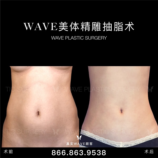 WAVE美亦恆整型外科集團─李建相醫師 图片 6