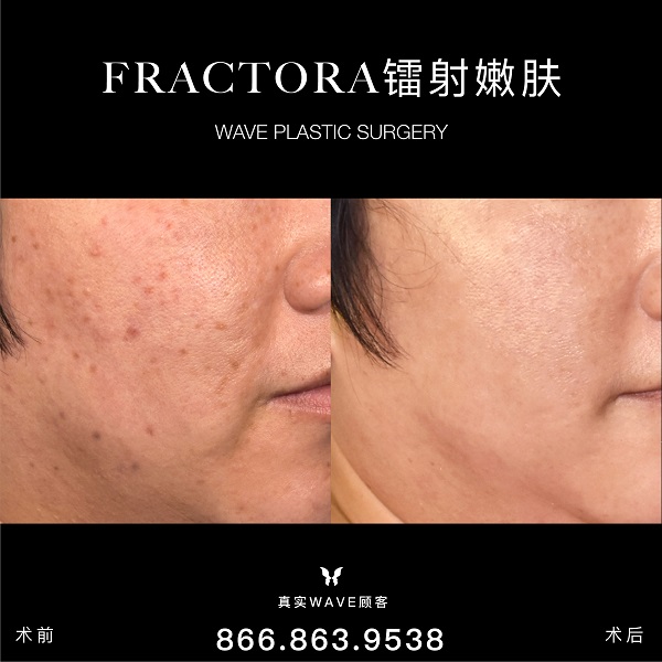 WAVE美亦恆整型外科集團─李建相醫師 图片 8