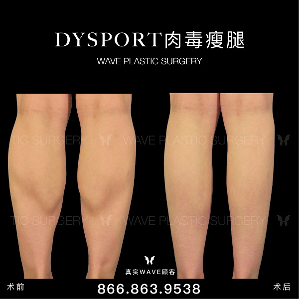 WAVE美亦恆整型外科集團─李建相醫師 图片 5