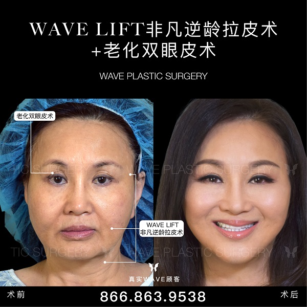 WAVE美亦恆整型外科集團─李建相醫師 图片 7