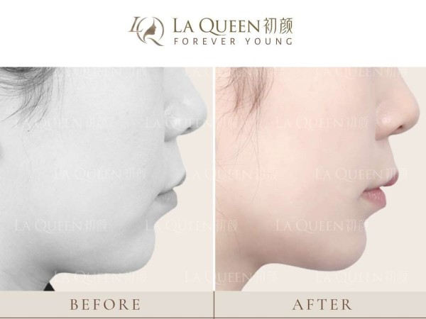 初顏輕奢醫美 图片 3