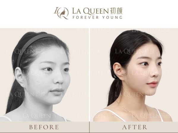 初顏輕奢醫美 图片 8