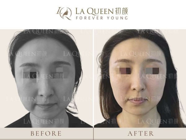 初顏輕奢醫美 图片 4