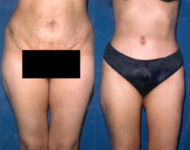 泰勒整型外科醫學美容中心 图片 8