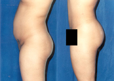 泰勒整型外科醫學美容中心 图片 7