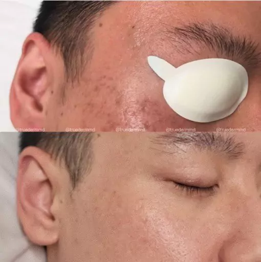 美國皮膚科學會認證─宋凱文醫師 图片 7