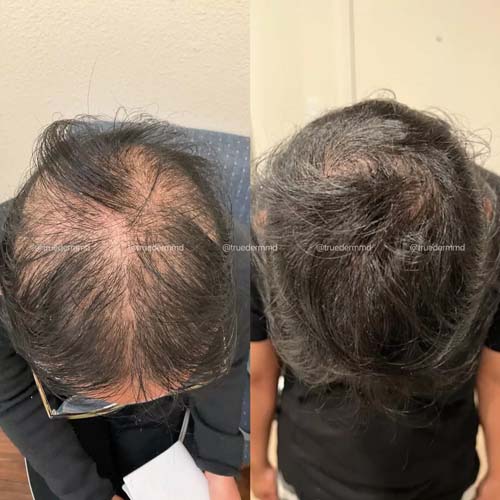 美國皮膚科學會認證─宋凱文醫師 图片 8