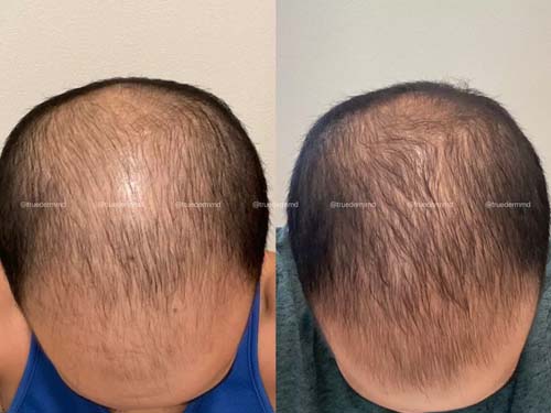 美國皮膚科學會認證─宋凱文醫師 图片 6