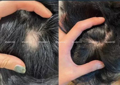 美國皮膚科學會認證─宋凱文醫師 图片 5