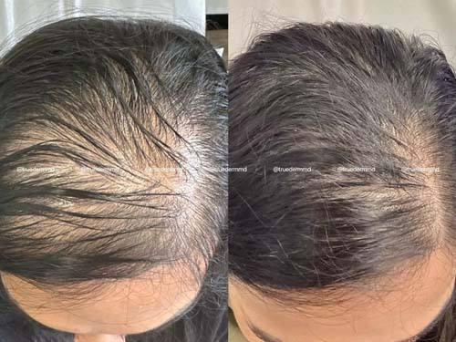 美國皮膚科學會認證─宋凱文醫師 图片 2