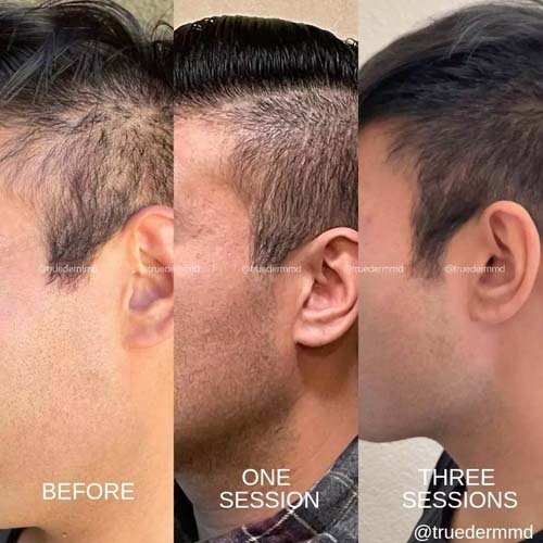 美國皮膚科學會認證─宋凱文醫師 图片 1