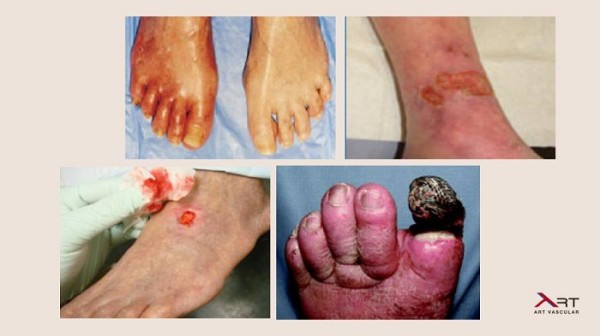 石未冬醫師─專業靜脈及動脈血管微創手術治療中心 图片 6