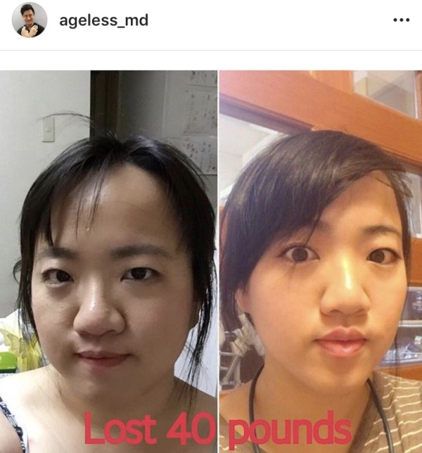 凍齡美學 图片 3