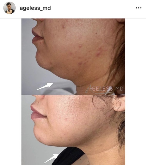 凍齡美學 图片 1