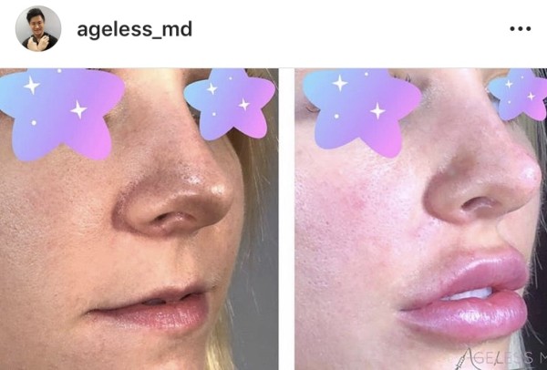 凍齡美學 图片 6