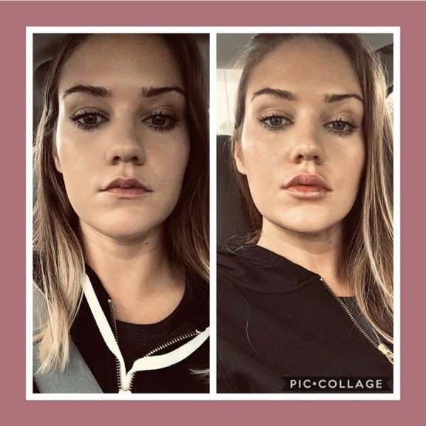 凍齡美學 图片 8