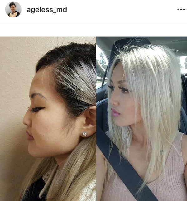 凍齡美學 图片 5