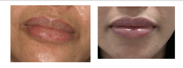 可麗兒韓國醫學美容診所 图片 6