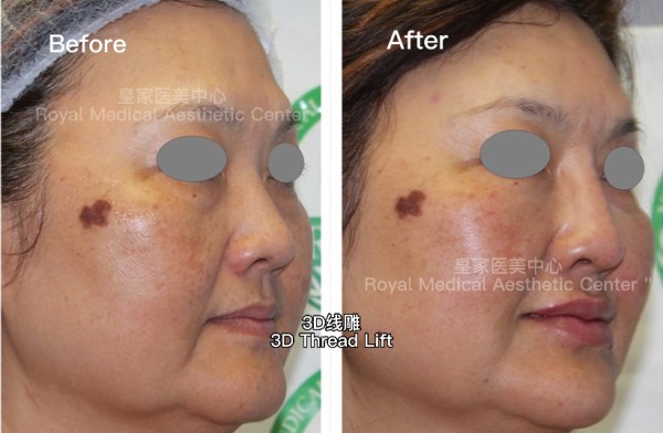 皇家醫學美容中心 图片 5