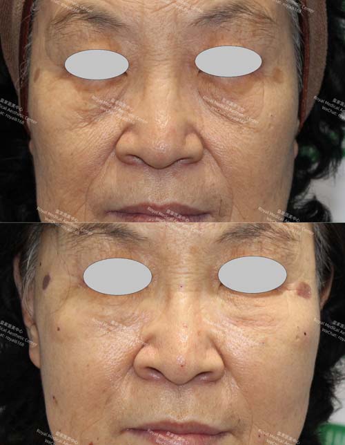 皇家醫學美容中心 图片 7