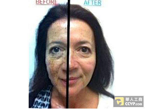 愛家醫美 图片 3