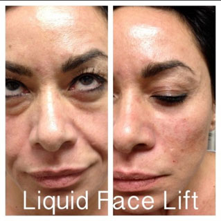 愛家醫美 图片 6