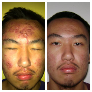 愛家醫美 图片 8