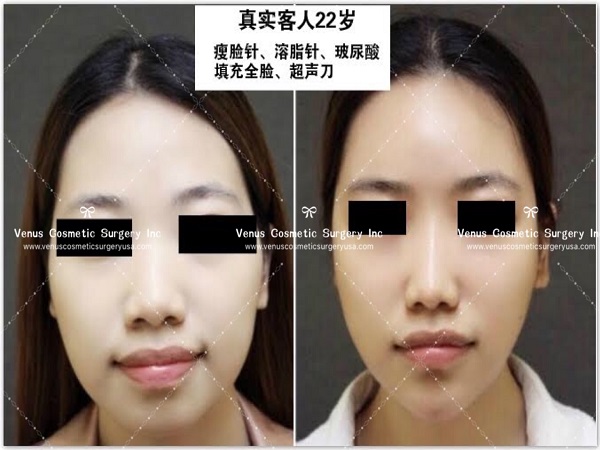 韓美明星整型中心 图片 5