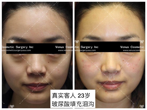 韓美明星整型中心 图片 6