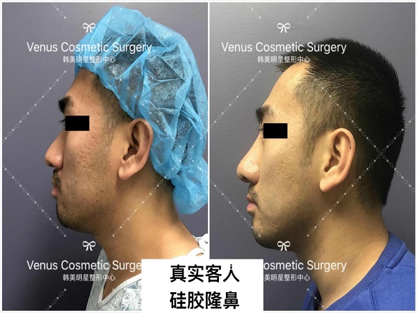 韓美明星整型中心 图片 8